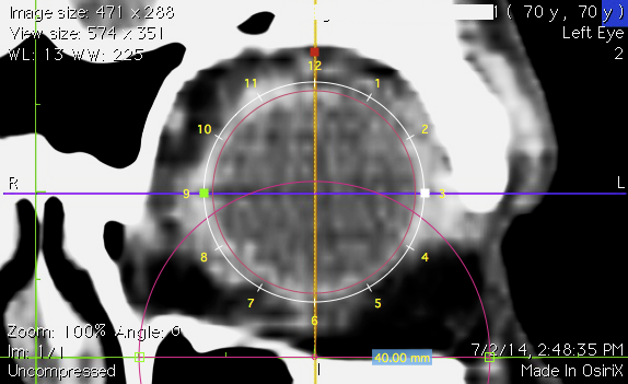 EquatorCalibrated