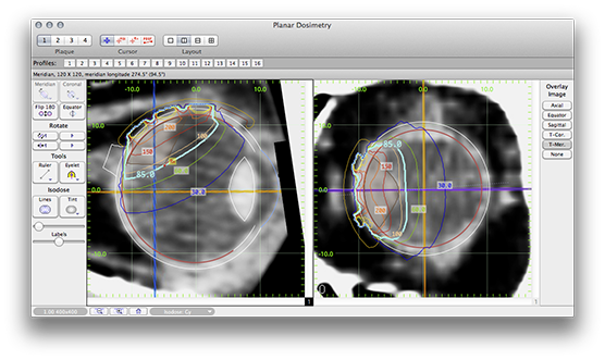 PP151PlanarDosimetry