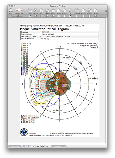 PP151RetinaPage1