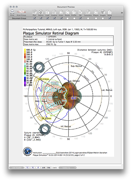 PP151RetinaPage2