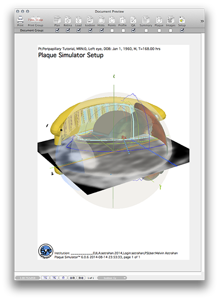 PP151SetupDocument