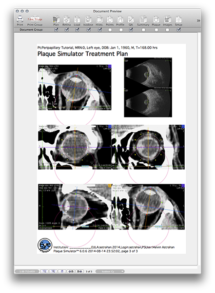 PP151TreatmentPlanPage3