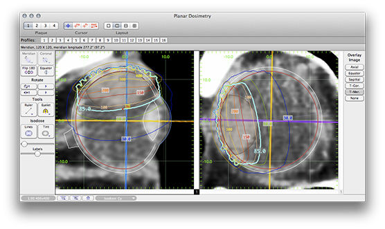 TT139PlanarDosimetry