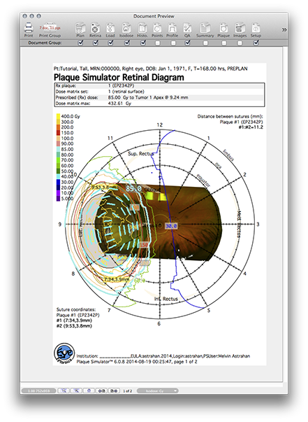 PP139RetinaPage1