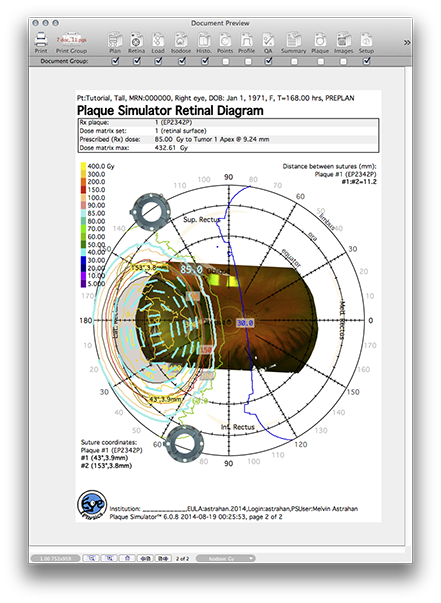 PP139RetinaPage2