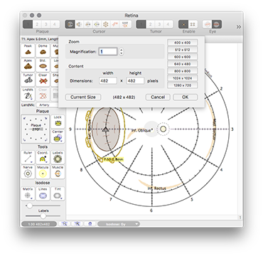 Retina