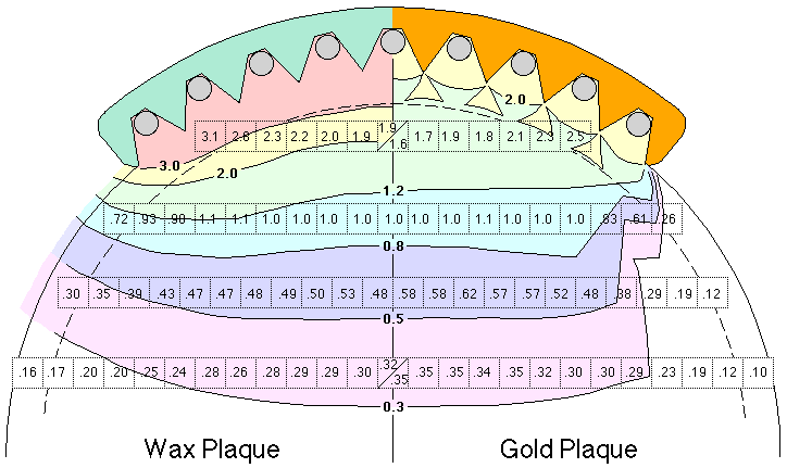 Figure11