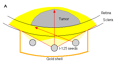 Figure1A