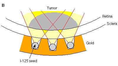 Figure1B